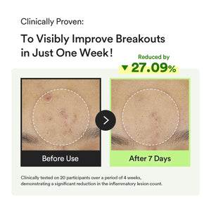 Heartleaf Teca Capsule Serum Calming Drop