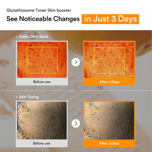 Glutathiosome dark spot toner Skin booster