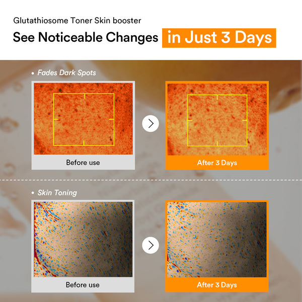 Glutathiosome dark spot toner Skin booster