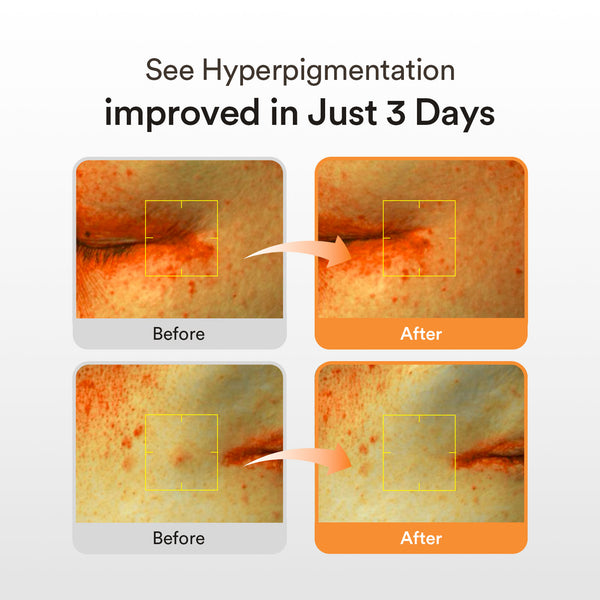 Glow Night Radiance Trio