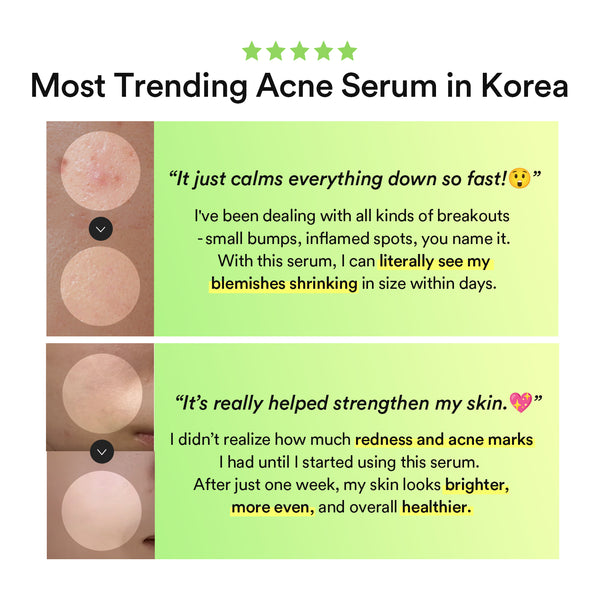 Heartleaf Teca capsule serum Calming drop