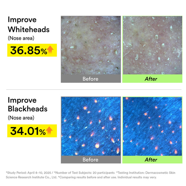 Pore-to-Glow Trio