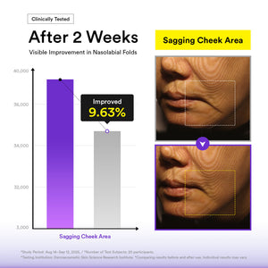 Silhouette Lifting Crème Mask V-up solution