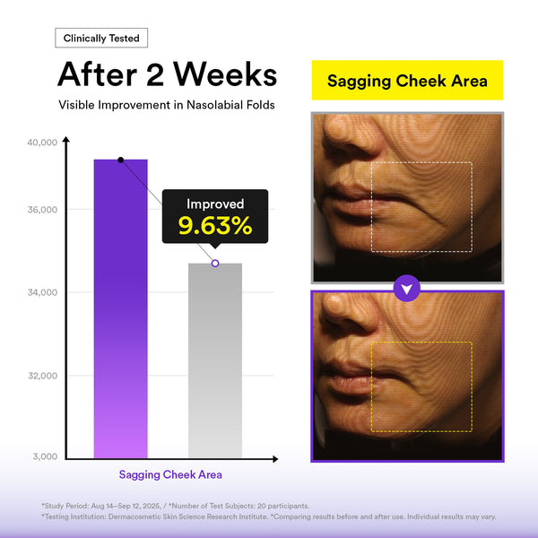 Silhouette Lifting Crème Mask V-up solution